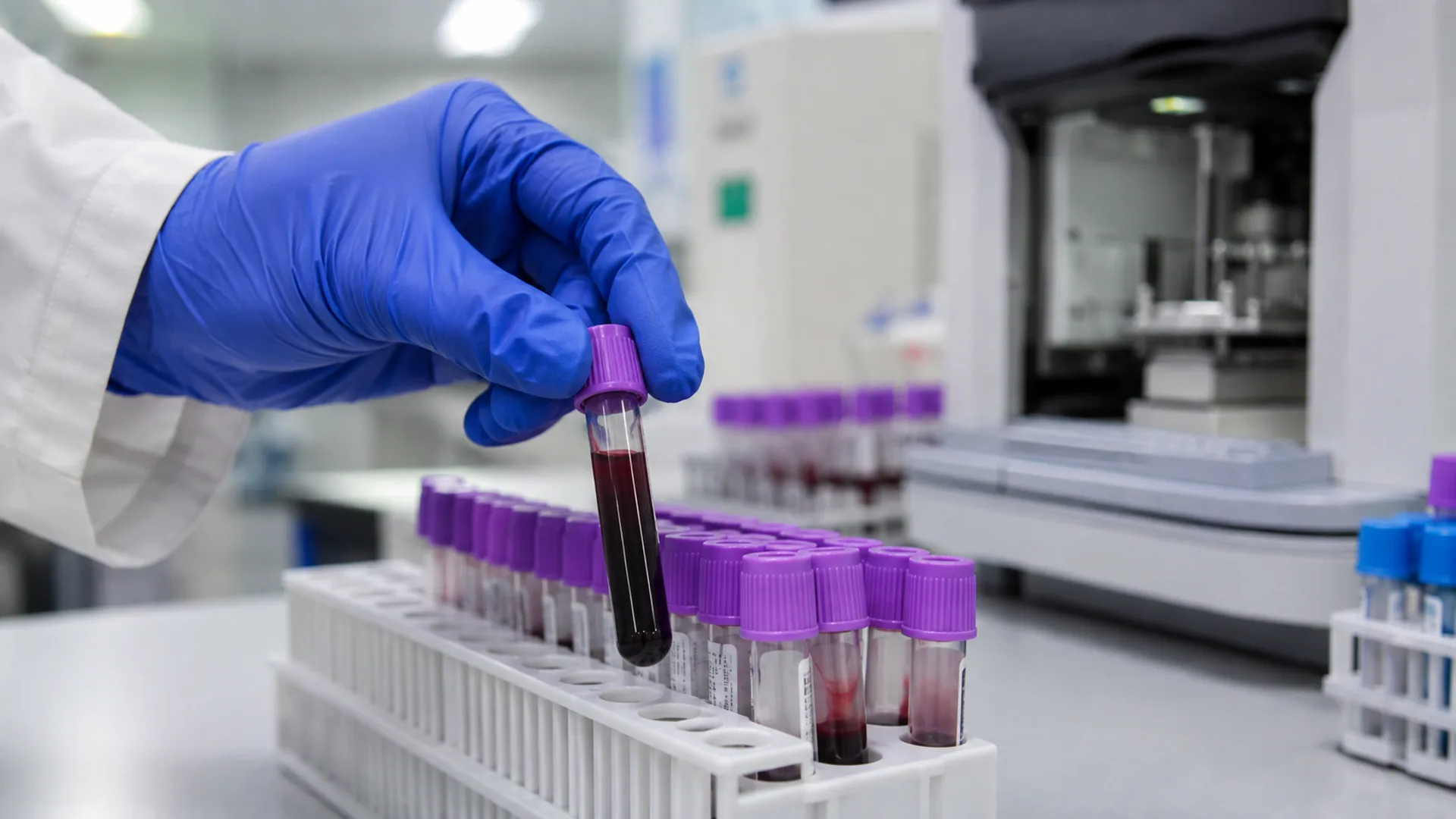 Blood sample being prepared for an A1C laboratory test